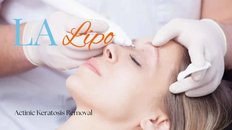 Woman receiving Actinic Keratosis Removal Treatment Northwich