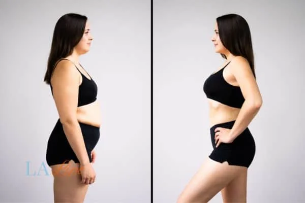 link between body image and mental health Northwich