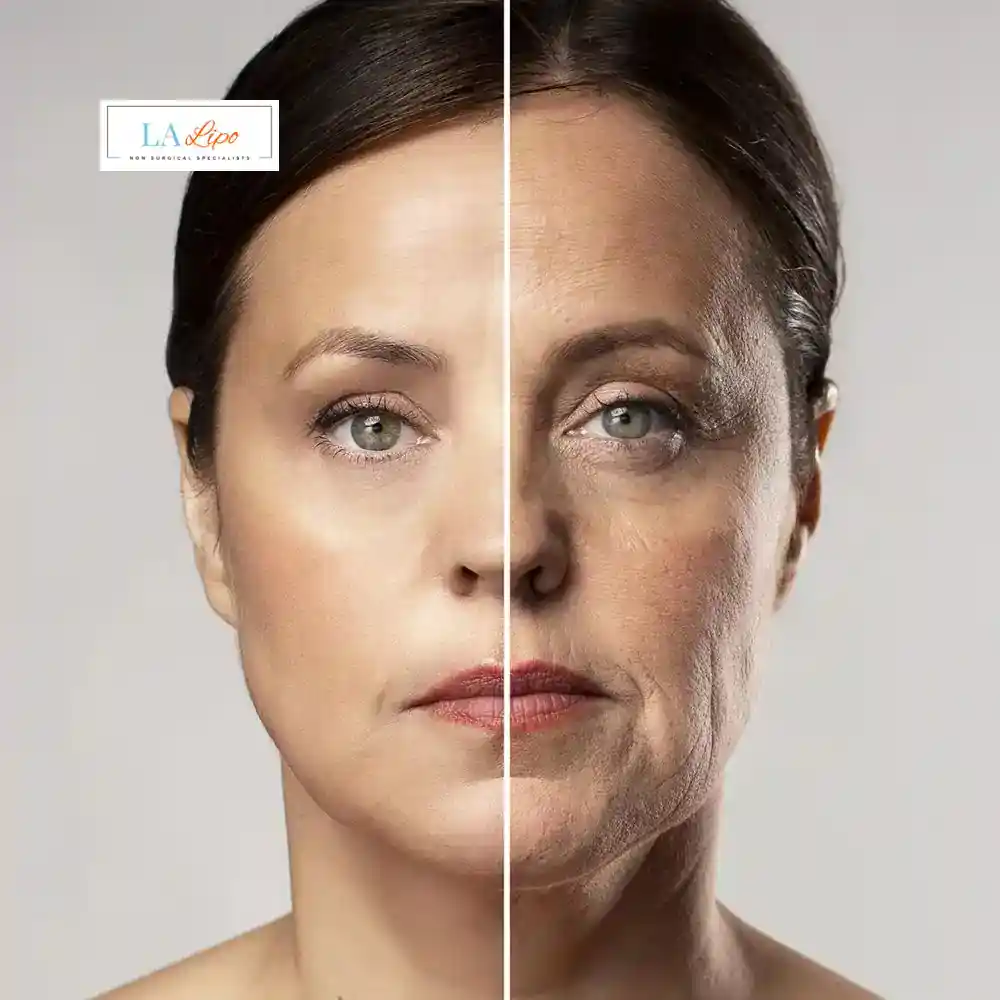 How Can You Tell If Non-Surgical Skin Tightening Is Right for You Northwich?