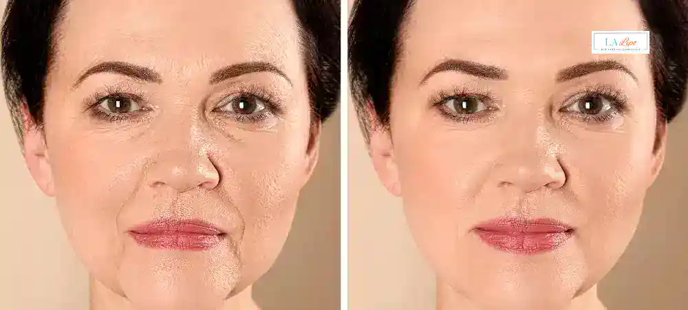 Why Aren’t My Skincare Products Making My Sagging Skin Look Firmer Northwich?